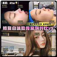 上海人气网红整形|上海网红整