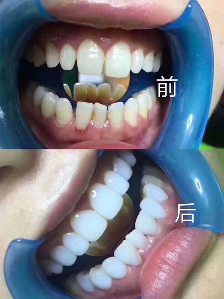 成都皮肤管理|成都皮肤管理培训