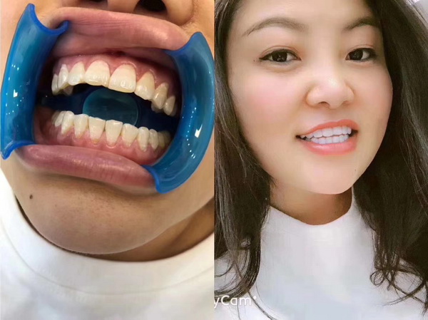 成都皮肤管理|成都皮肤管理培训