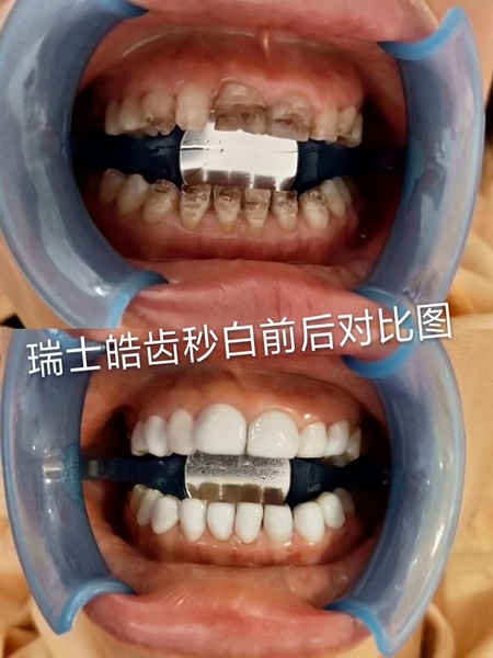 成都皮肤管理|成都皮肤管理培训