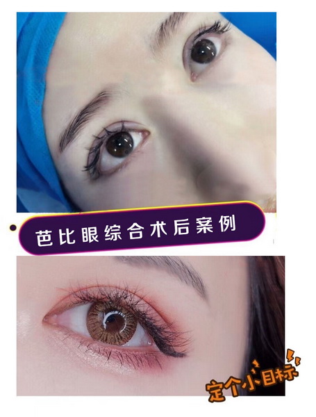 广州网红整形|广州网红整形医院