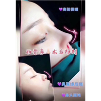 广州网红整形医院|广州人气网