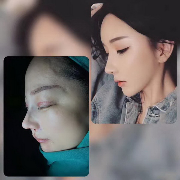 广州网红整形医院|广州人气网红整形
