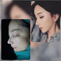 广州网红整形医院|广州人气网