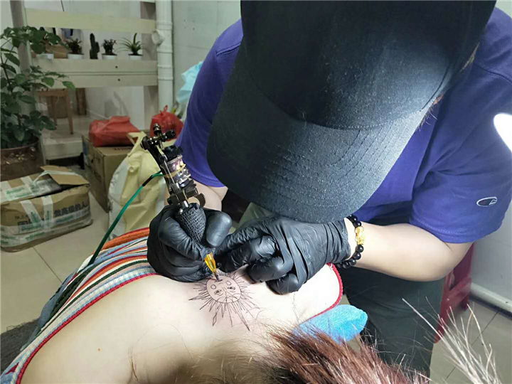 泉州纹身_洗纹身可以找皮肤科医生协助 