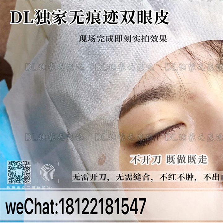 DL日式无痕双眼皮 