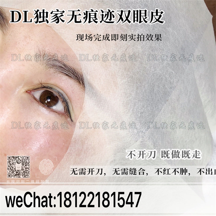 DL日式无痕双眼皮