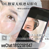 DL日式无痕双眼皮