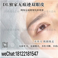 日式无痕双眼皮