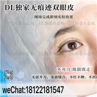 日式无痕双眼皮