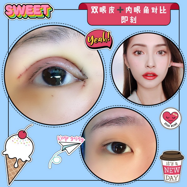上海久愿整形医院贵吗