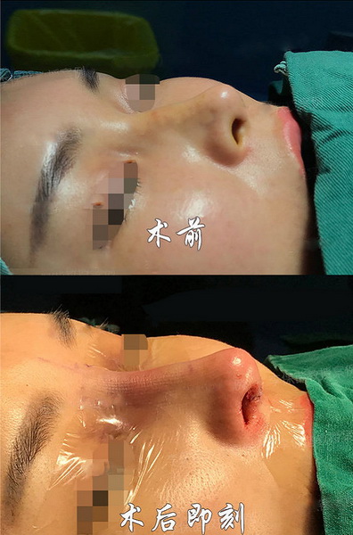 上海久愿整形医院贵吗