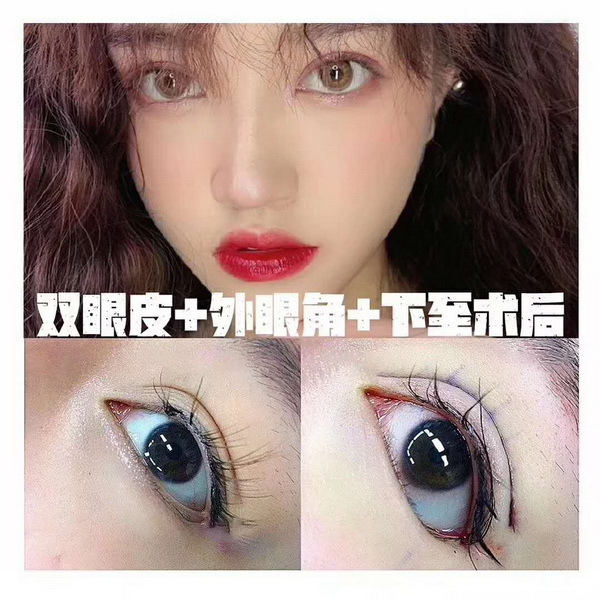 久愿国际整形医院