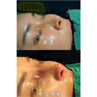 上海久愿整形医院贵吗