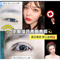 上海久愿整形医院贵吗