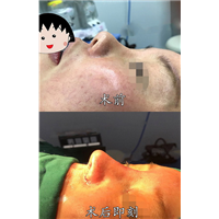 上海久愿整形医院贵吗