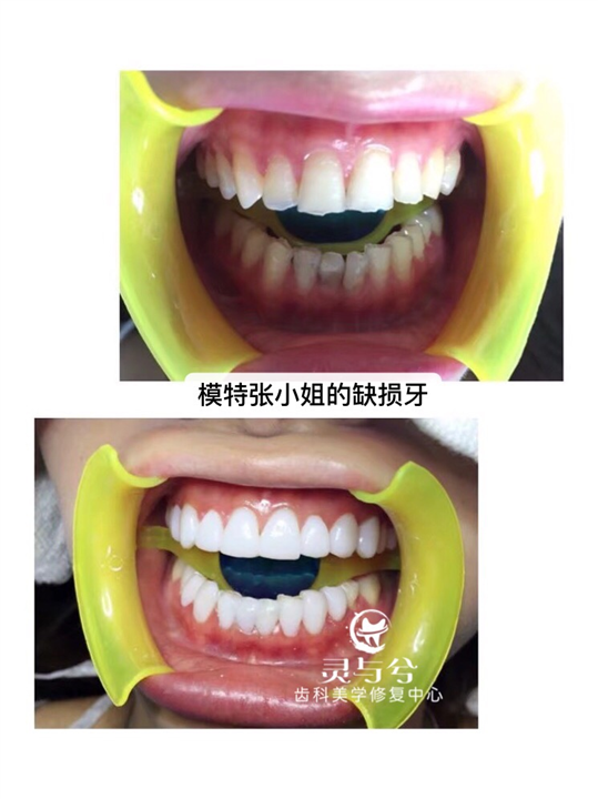 重庆美牙培训,重庆牙齿美白培训