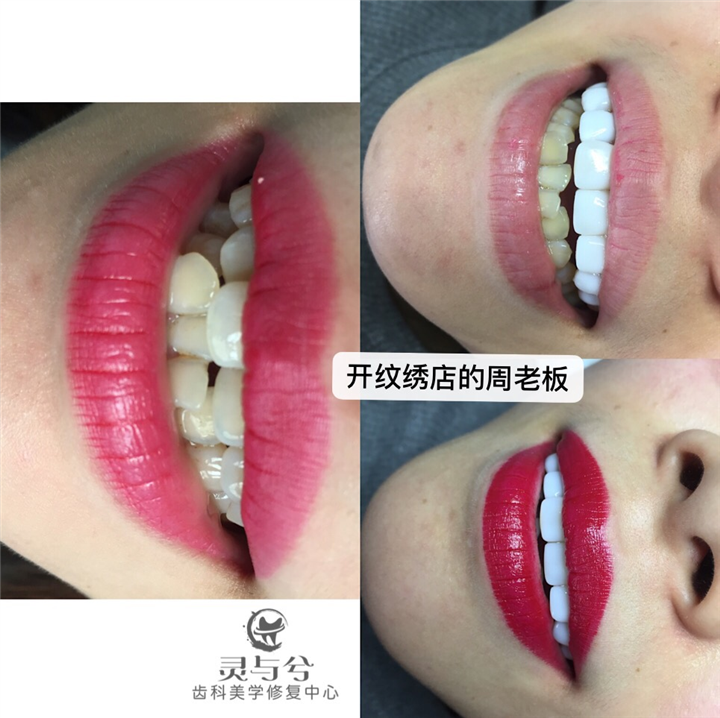 重庆美牙培训哪家好