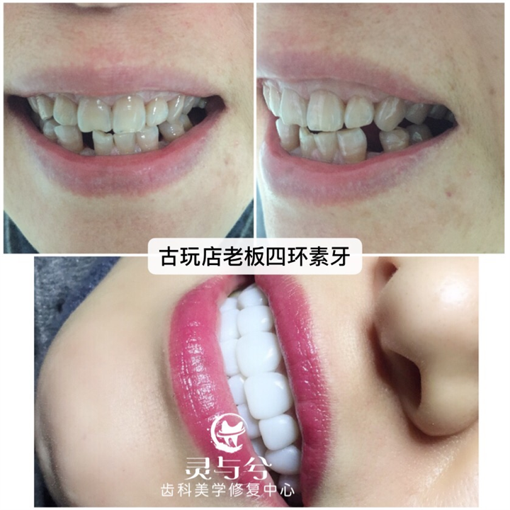 重庆美牙培训学校哪家好