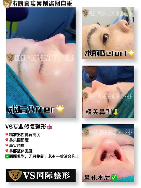 上海VS国际整形官网