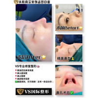 上海VS国际整形官网