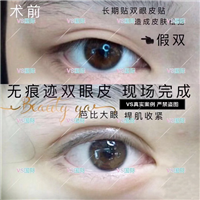 上海VS国际|上海VS整形