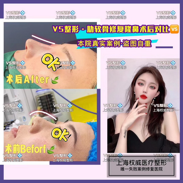 上海VS国际整形官网