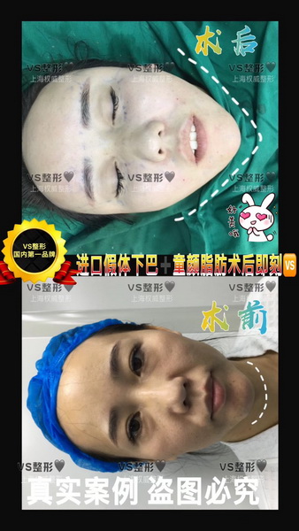 上海专业整形修复