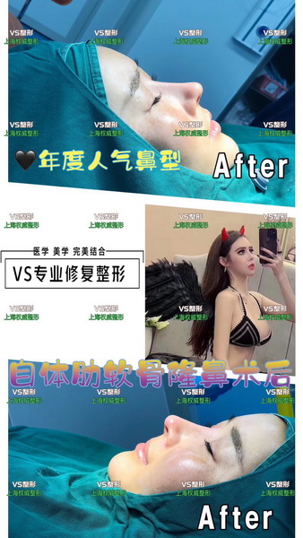 上海VS国际整形官网