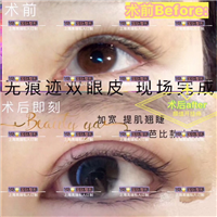 上海VS国际|上海VS整形