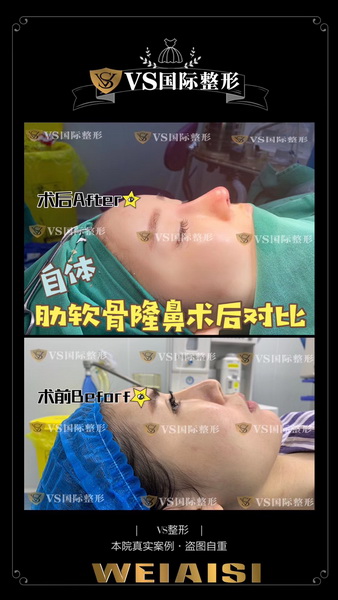 上海VS国际整形官网