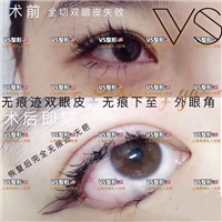 上海VS国际|上海VS整形