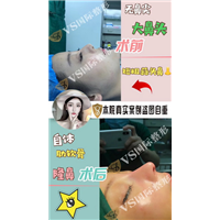 上海VS国际整形官网