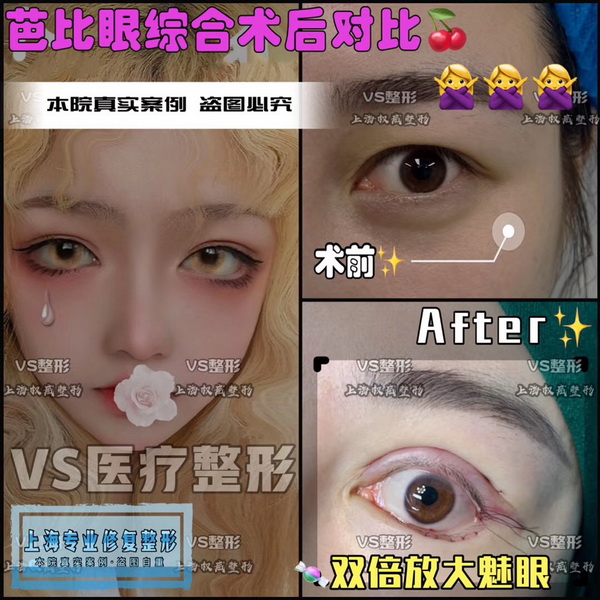 上海国际整形