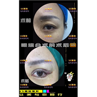 上海人气网红整形