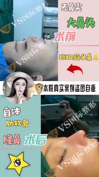 上海VS国际整形官网