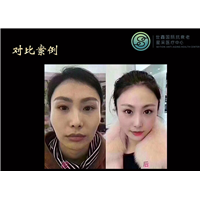 活细胞抗衰老中心