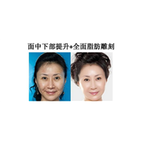上海抗衰老中心
