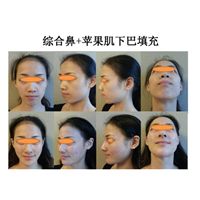 上海抗衰老中心