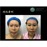活细胞抗衰老中心