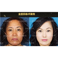 陶宏炜