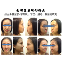 上海抗衰老中心