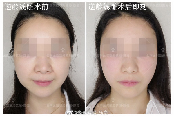 重庆眼部整形专家