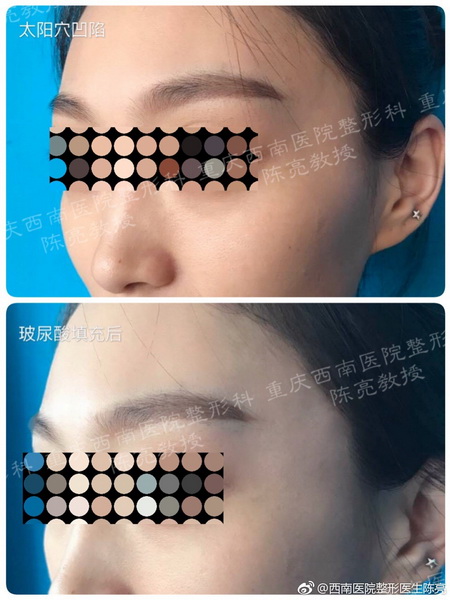 重庆整形专家