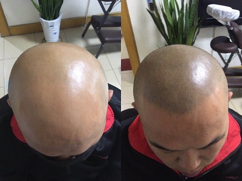 山西太原纹发机构