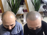 山西太原纹发】