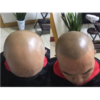 山西太原纹发机构