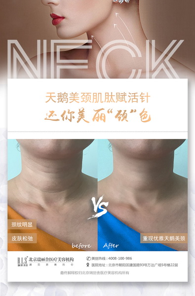 颈纹