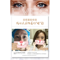美眼重睑修复