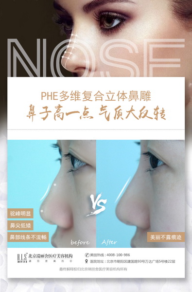 注射隆鼻